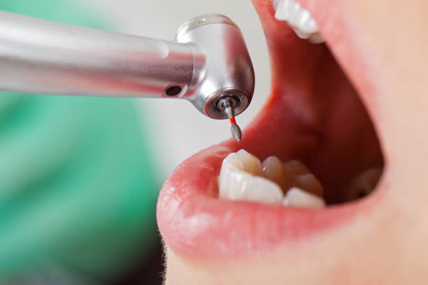 Best Emergency Cosmetic Dentistry in Rosemont, IL